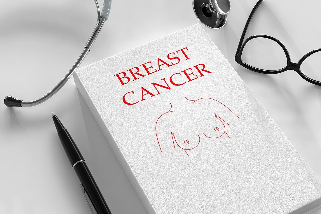 Breast cancer research and treatment, conceptual image