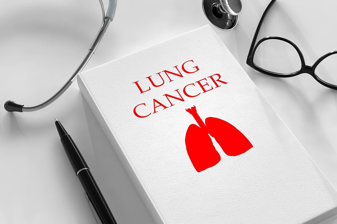 Lung cancer research and treatment, conceptual image