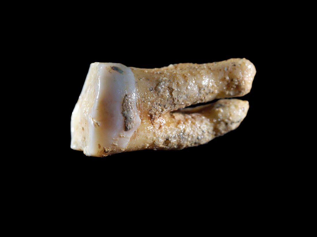 Neanderthal tooth