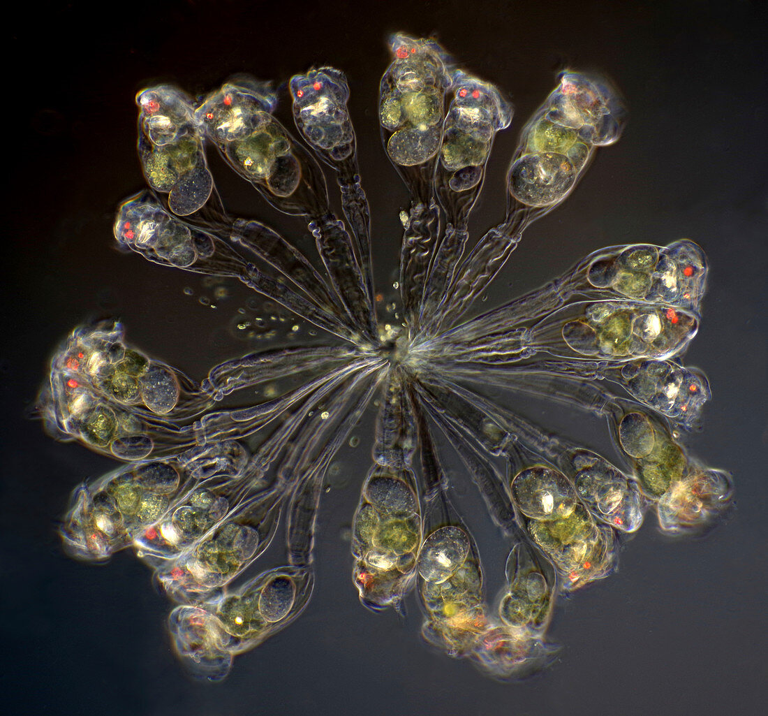 Rotifer colony, light micrograph