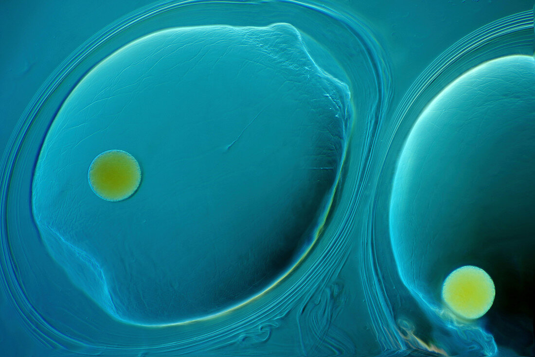 Water snail eggs, light micrograph