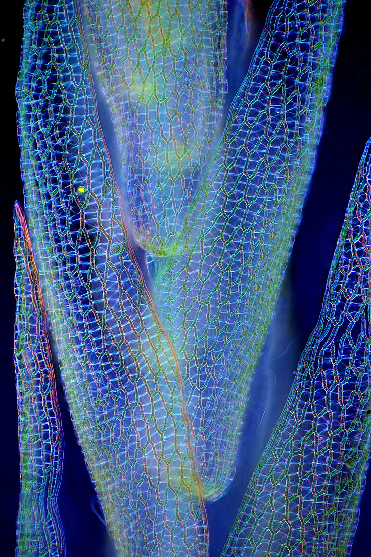 Sphagnum sp. moss, light micrograph