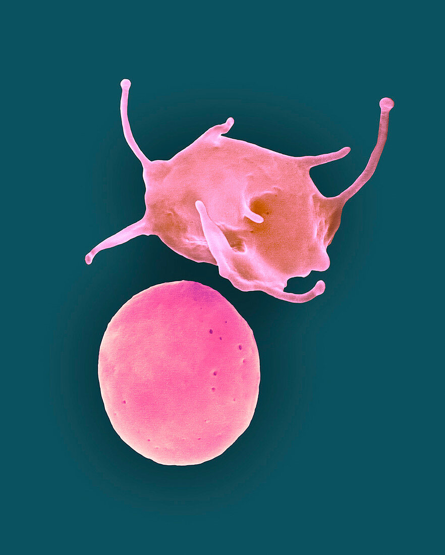 Activated and non-activated platelets, SEM