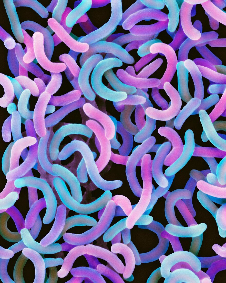 Vibrio cholerae bacteria, SEM