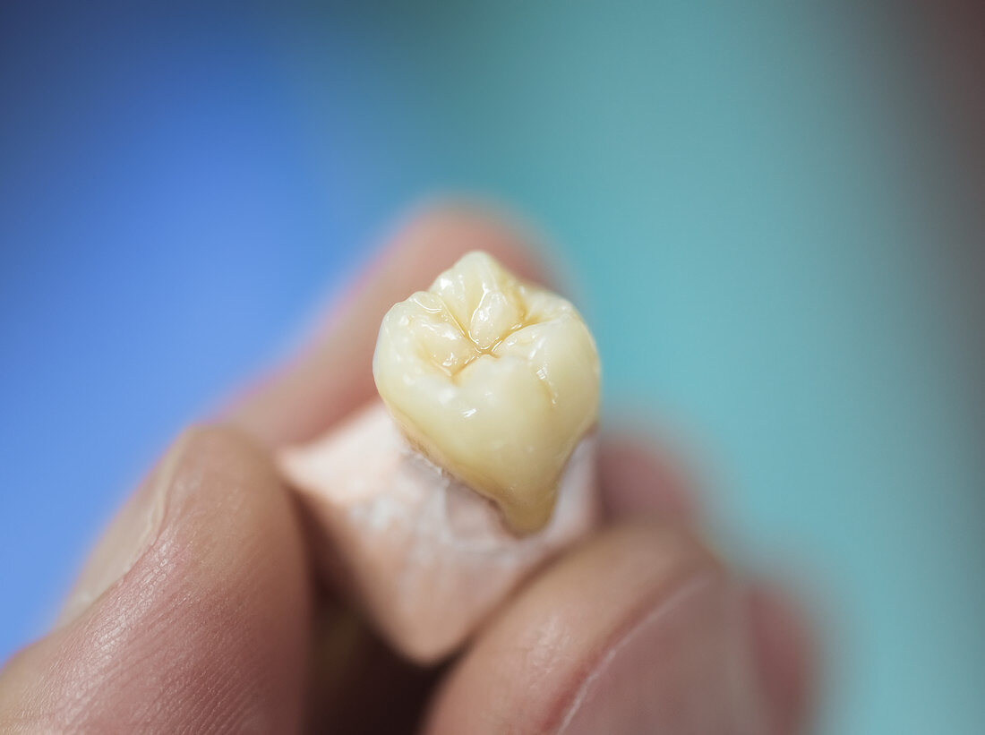 Artificial tooth being made