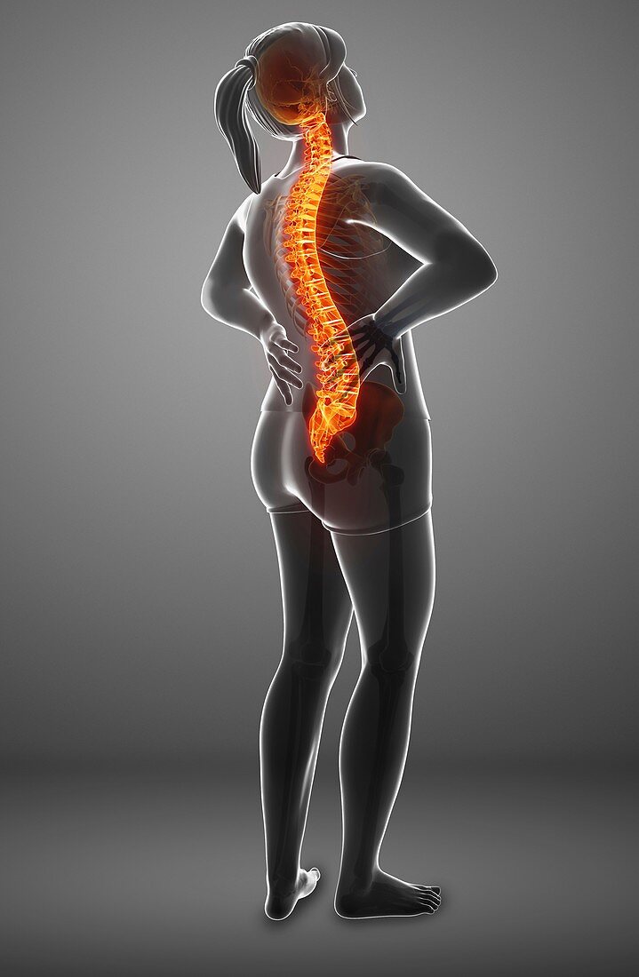 Woman with back pain, illustration