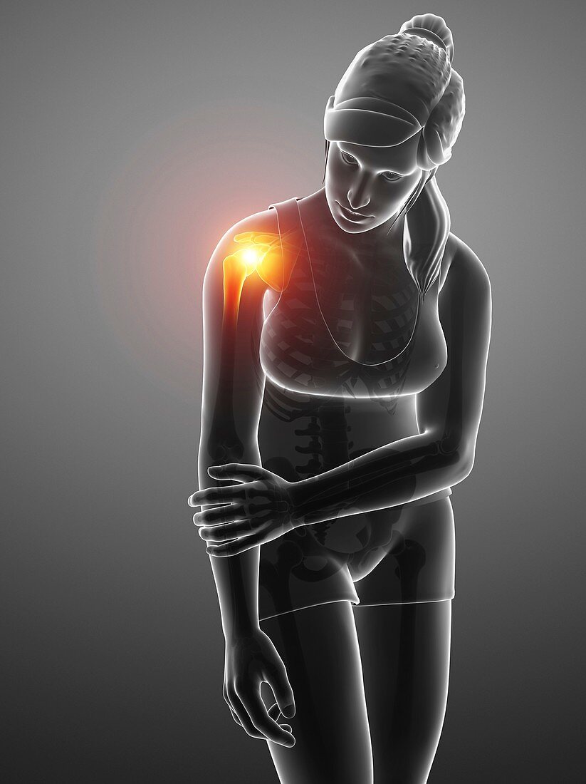 Woman with a painful shoulder, illustration
