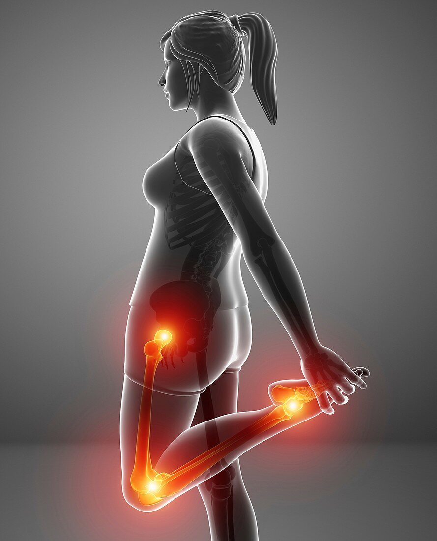 Woman with leg pain, illustration