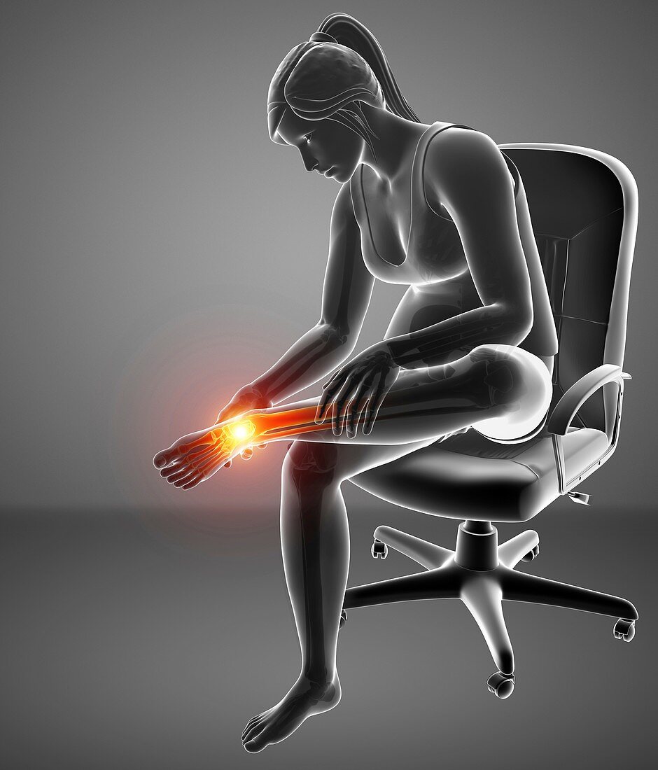 Woman with foot pain, illustration