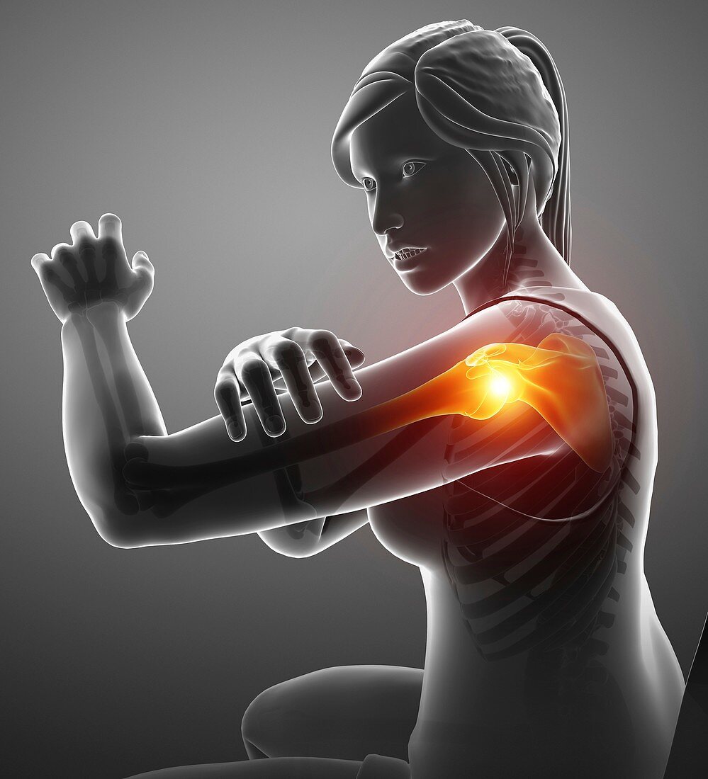 Woman with a painful shoulder, illustration