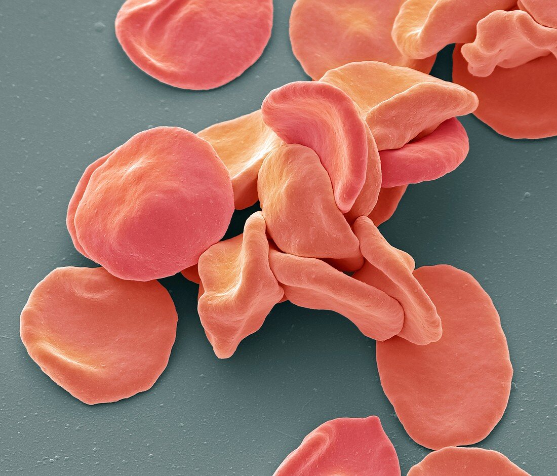 Red blood cells, SEM