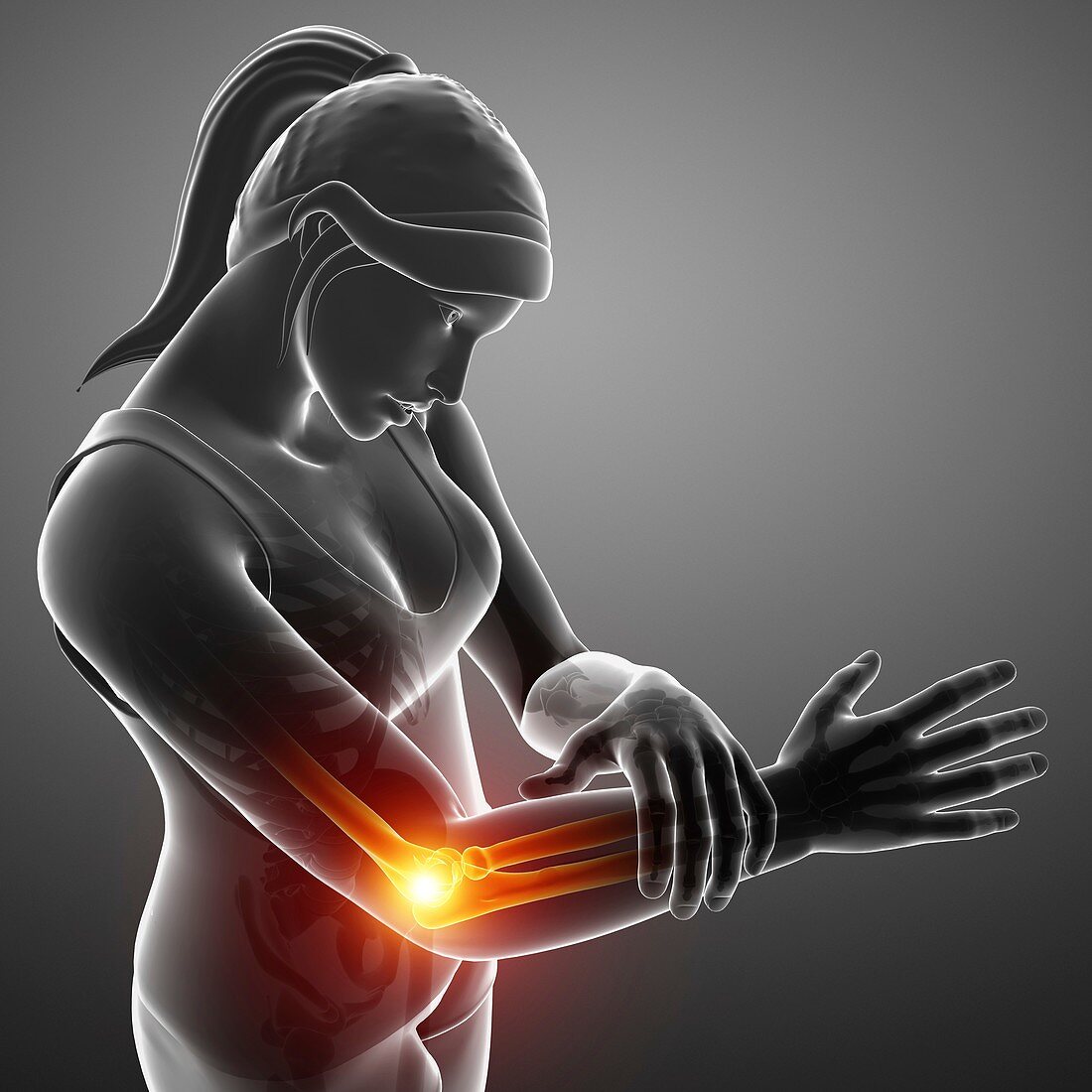Woman with elbow pain, illustration