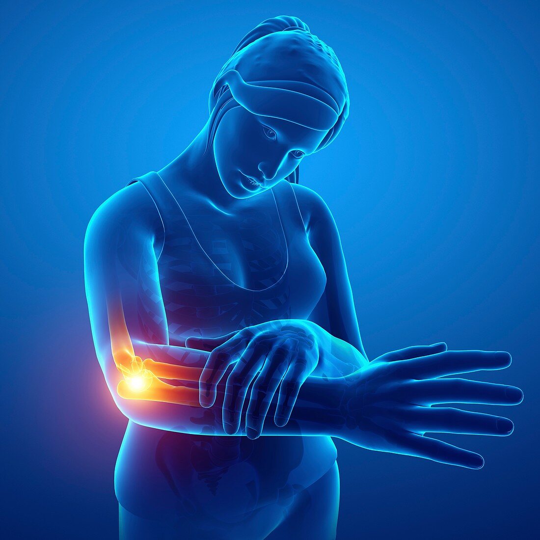 Woman with elbow pain, illustration