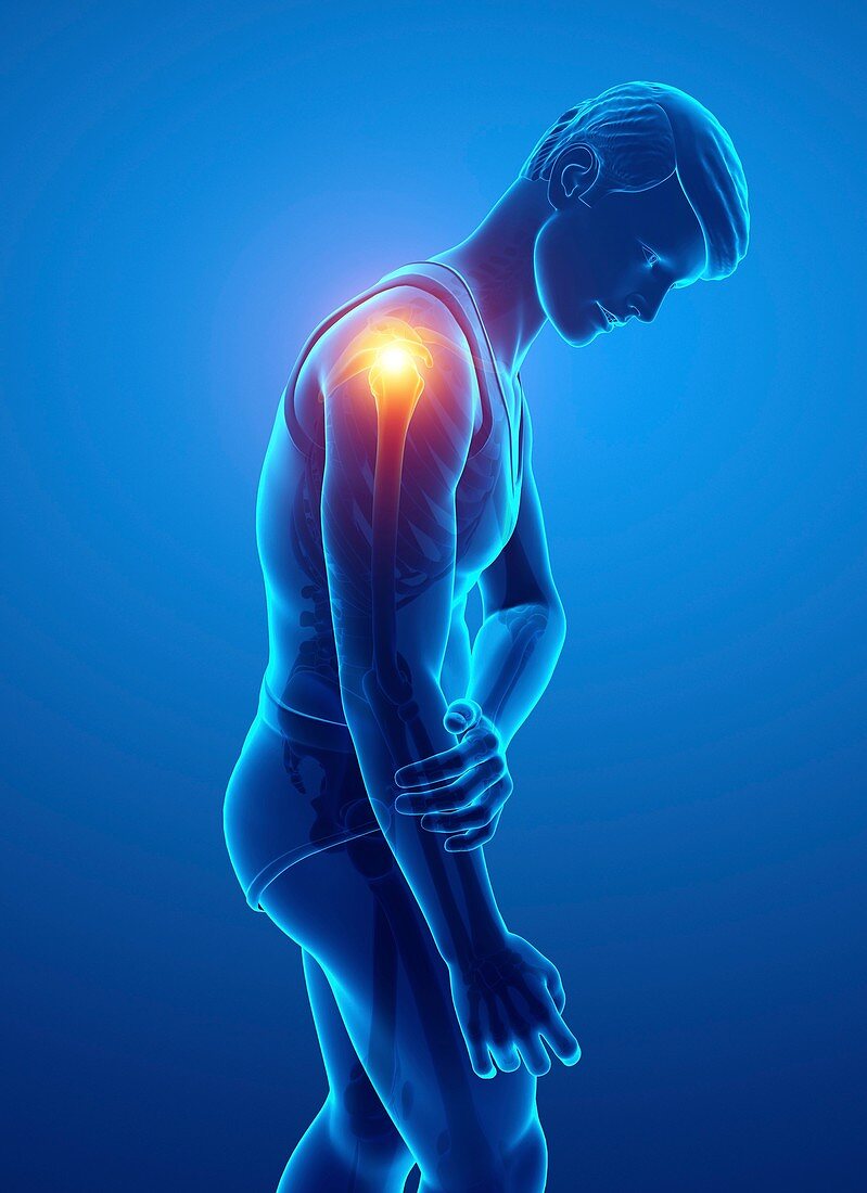 Man with shoulder pain, illustration