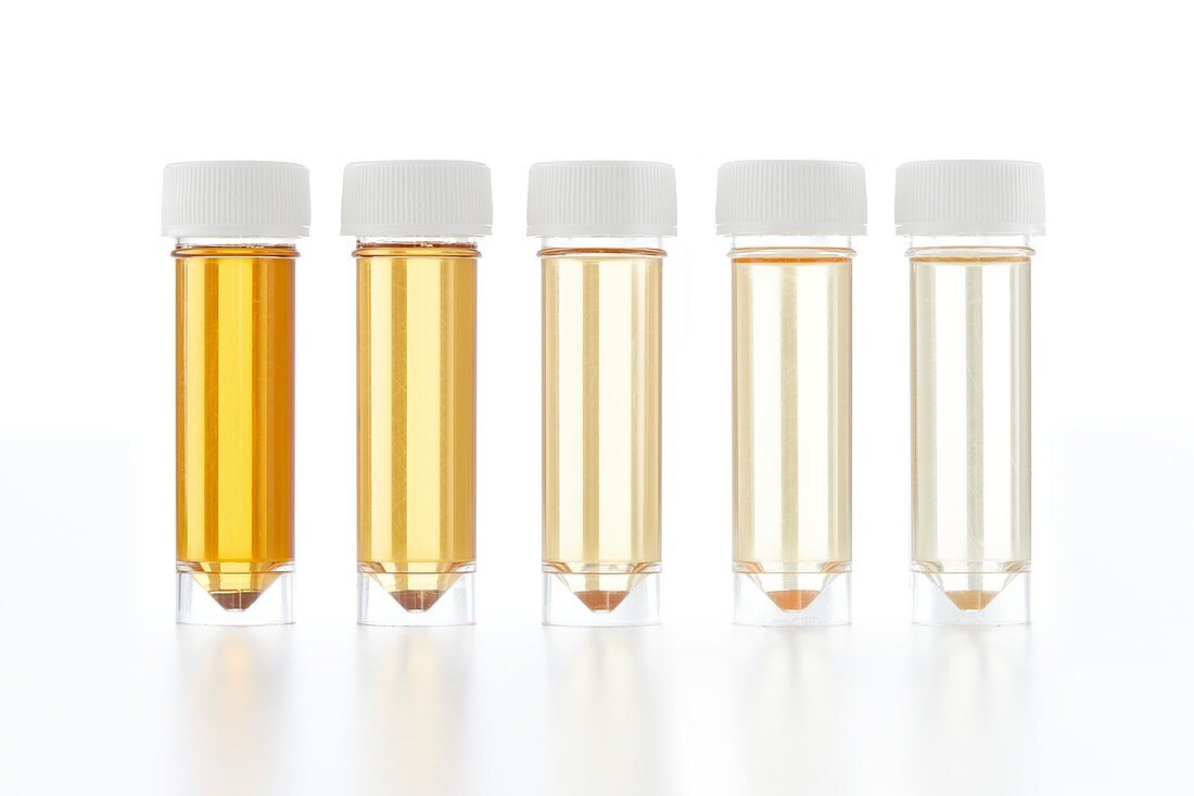 Urine samples for analysis