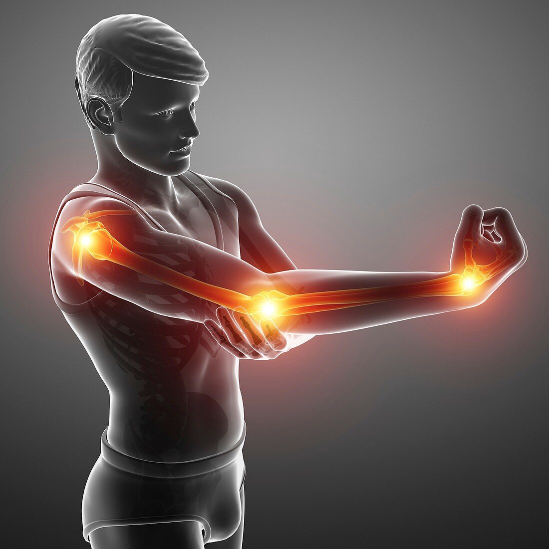 Man with arm pain, illustration