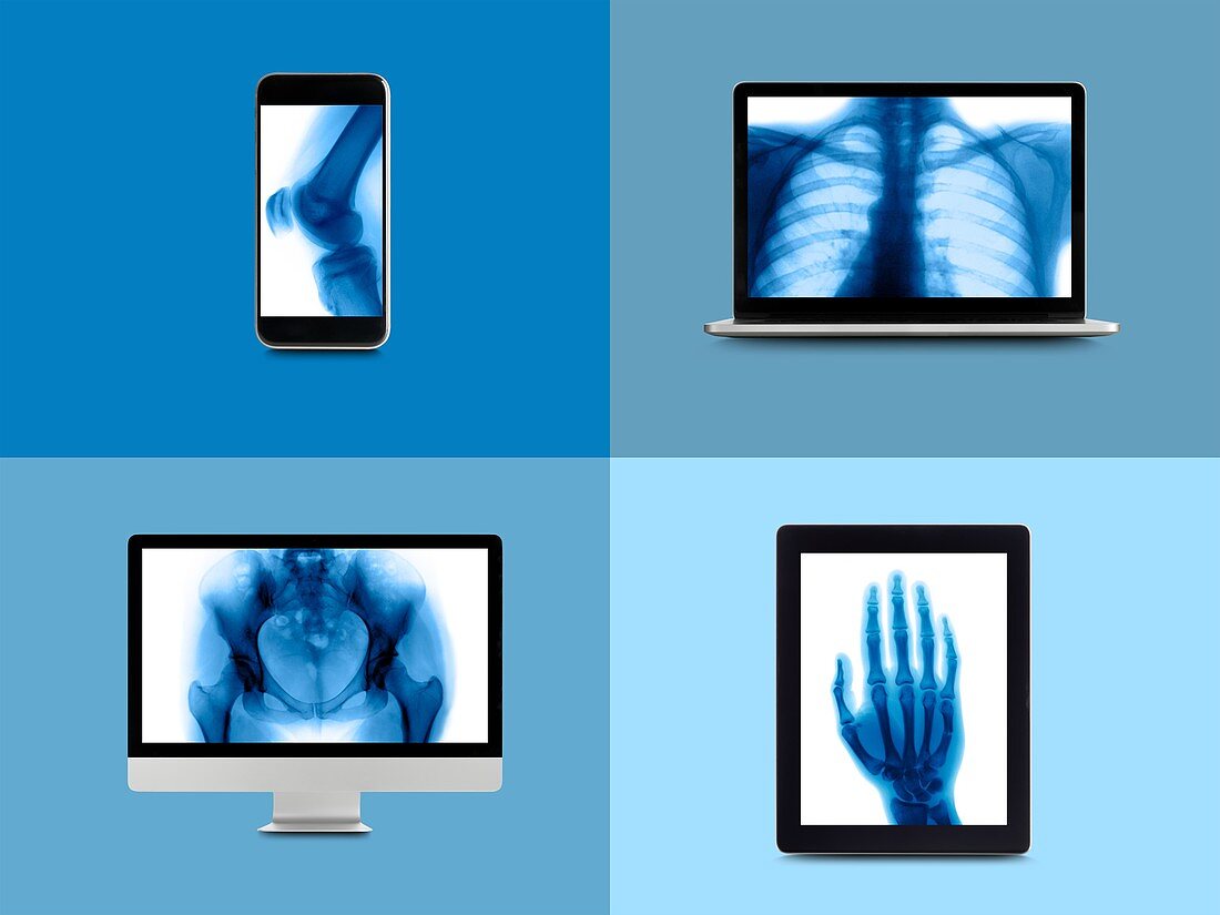 X-ray montage on digital device screens