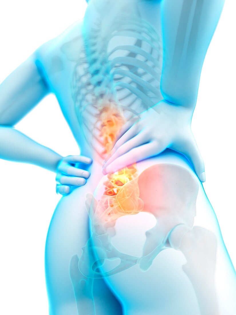 Human spine and back pain, illustration