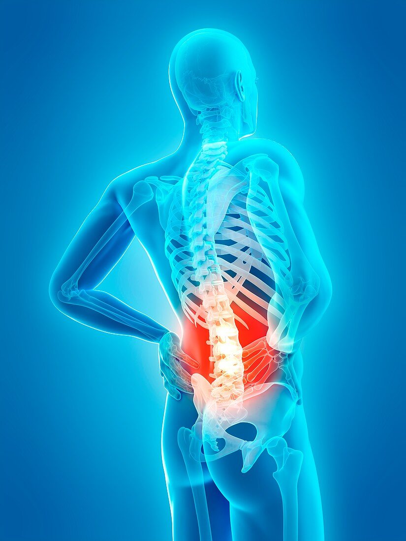Human spine and back pain, illustration