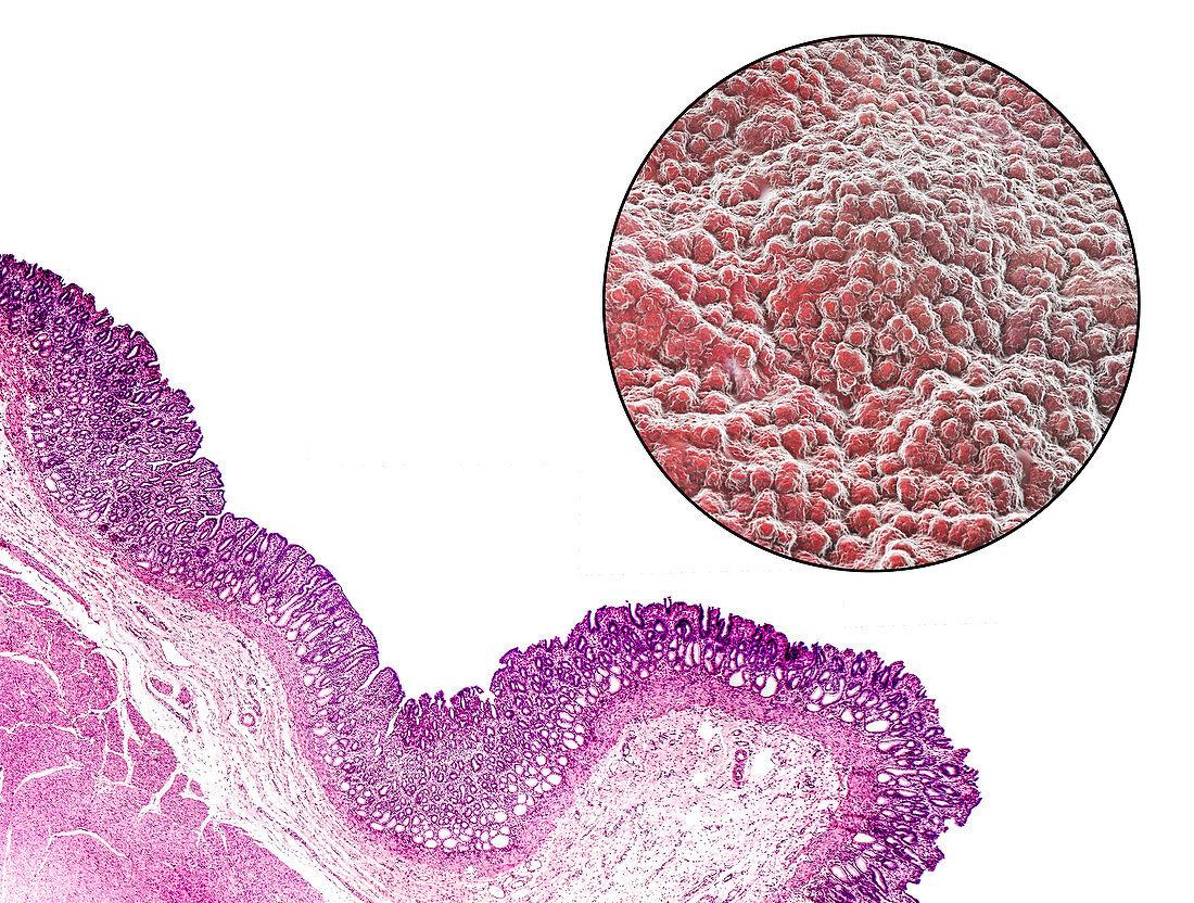 Stomach mucosa, light micrograph and illustration