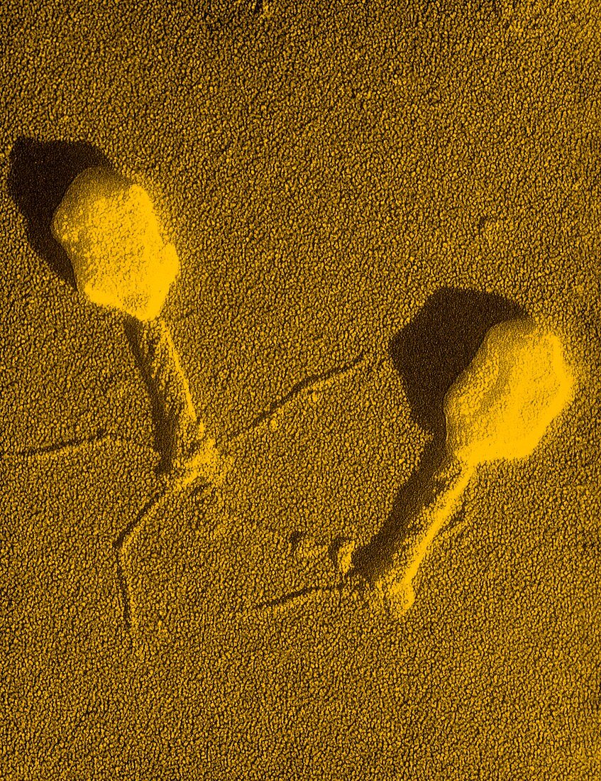 False-col TEM of T4 bacteriophage infecting E.coli