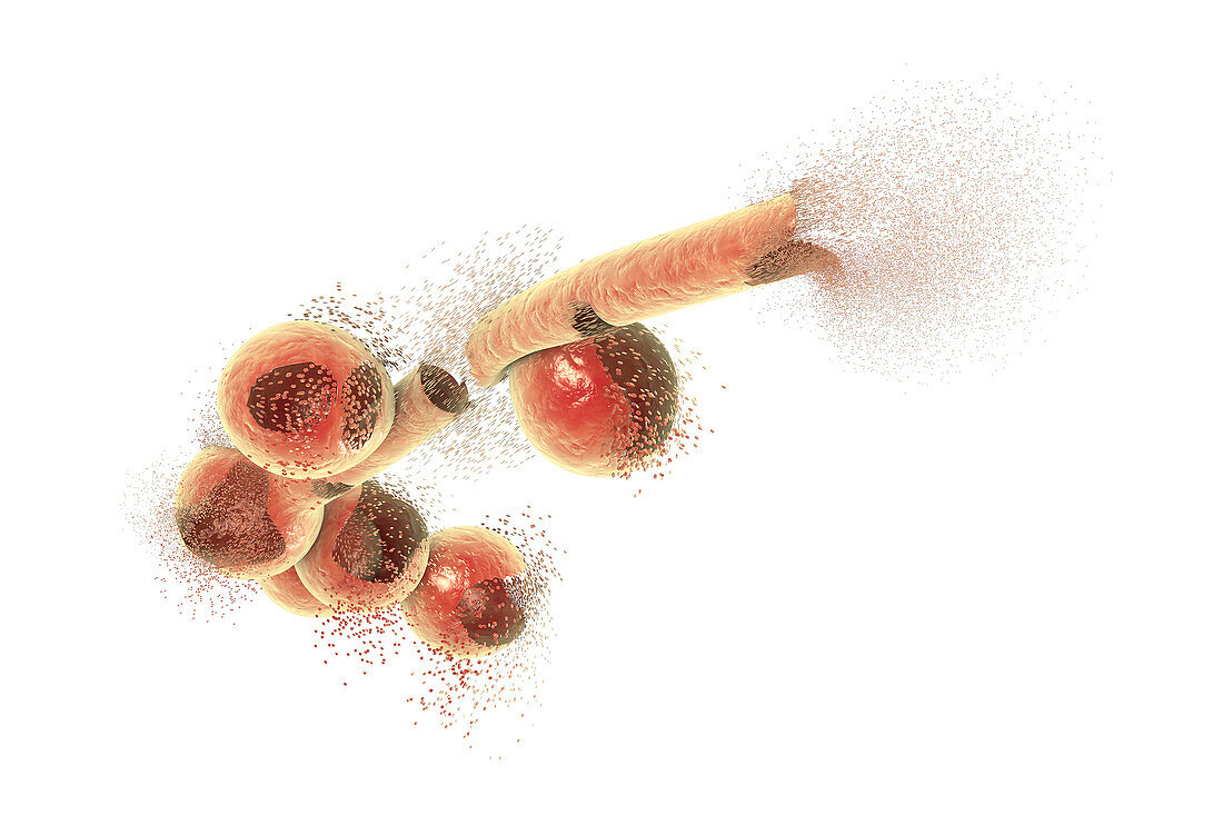 Destruction of Candida fungi, illustration