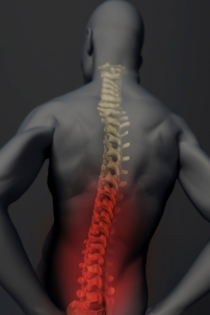 Lower Back Pain, artwork
