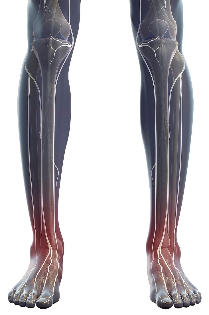 Nerves of the Legs, artwork