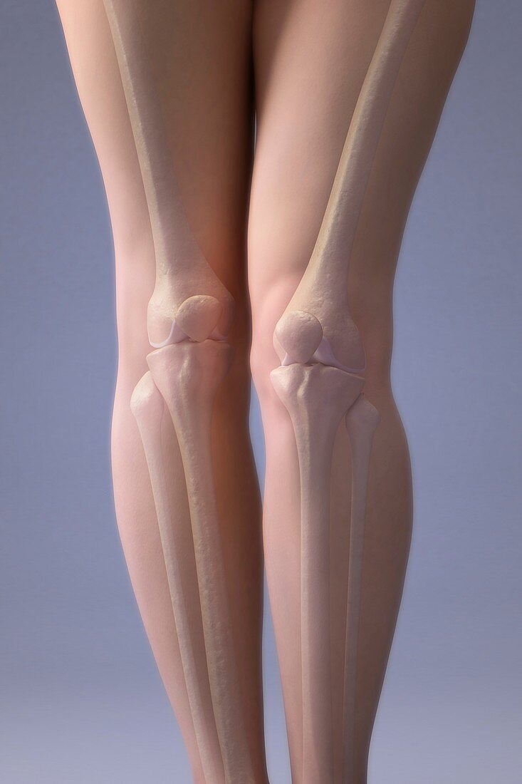The Bones of the Legs, artwork
