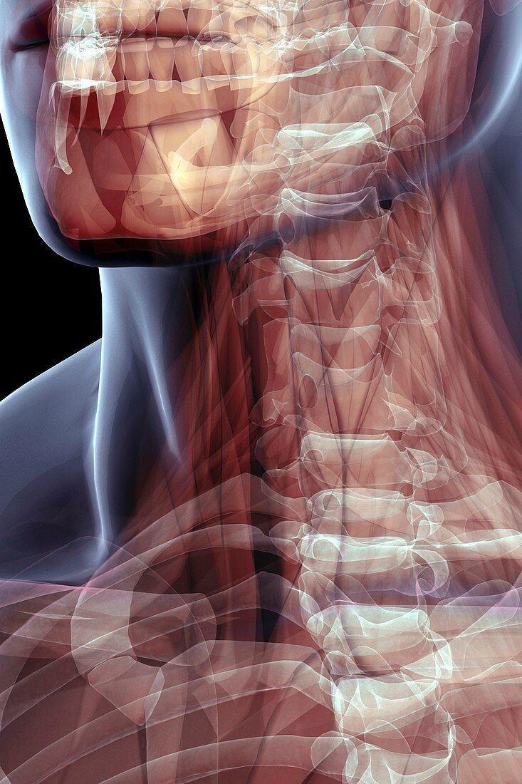 The Muscles of the Neck, artwork