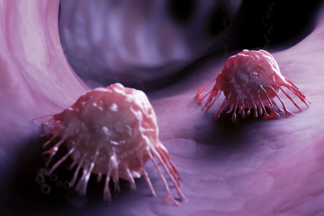 Cancer Cells, artwork