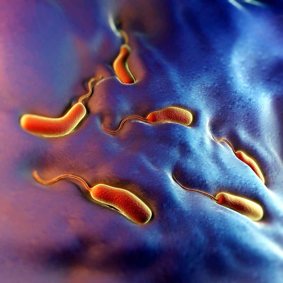 Cholera Bacteria, artwork