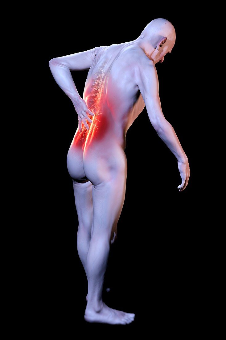Back Pain, artwork