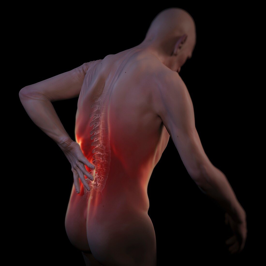 Back Pain, artwork