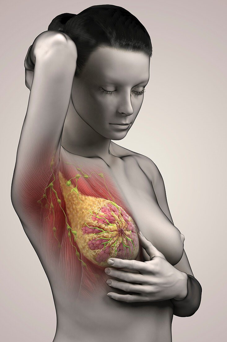 Breast Examination, artwork