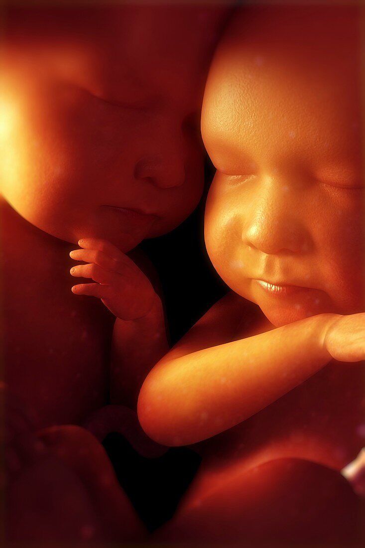 Twin Babies, artwork