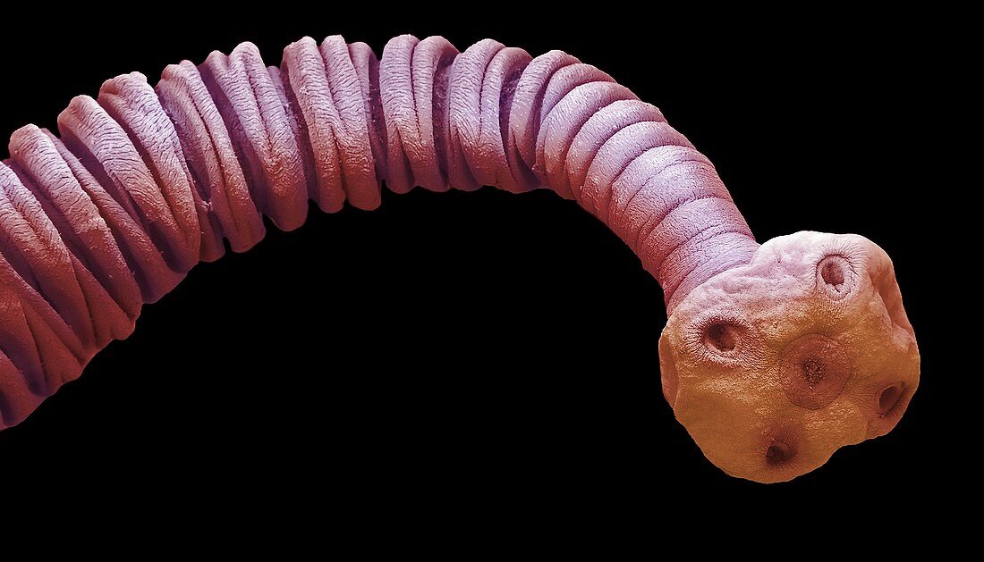 Tapeworm metacestode, SEM
