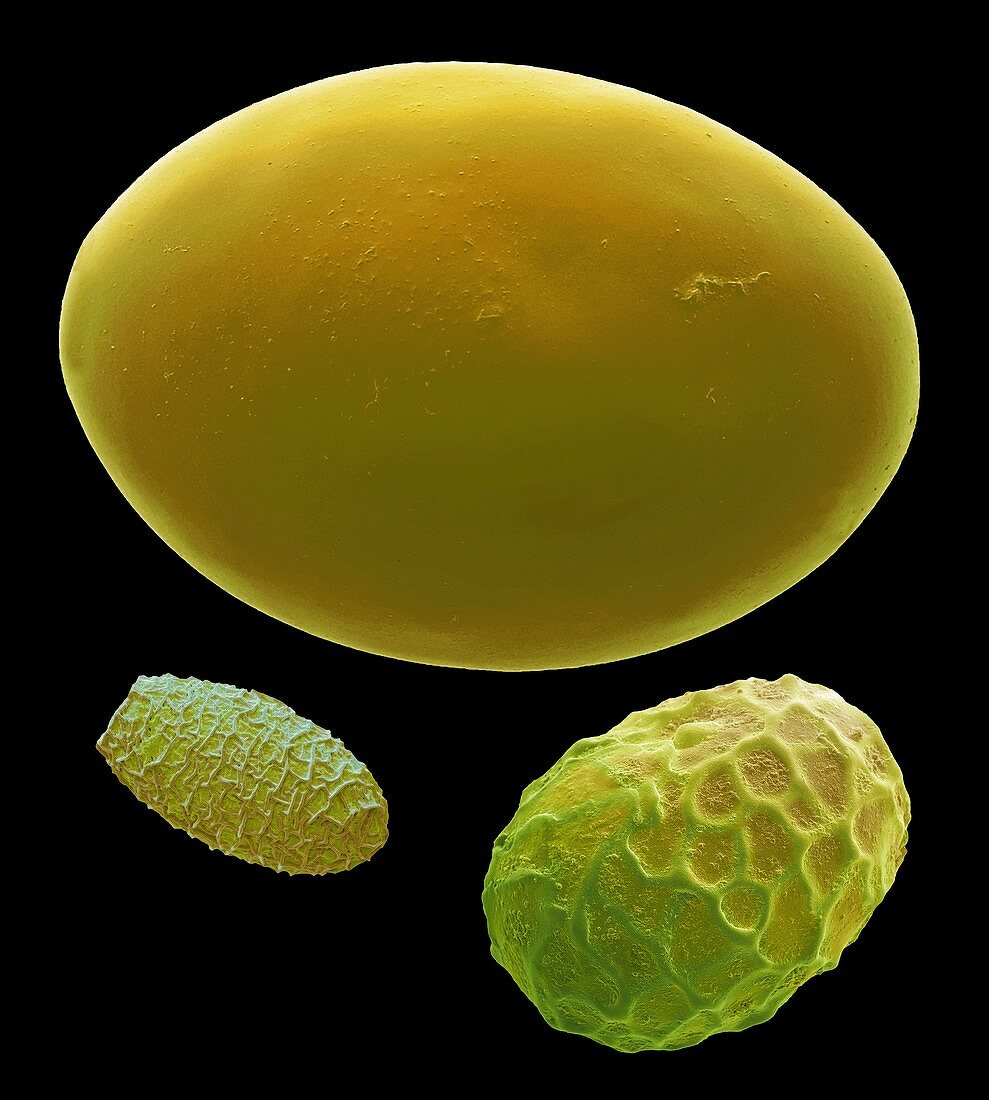 Parasite eggs, SEM