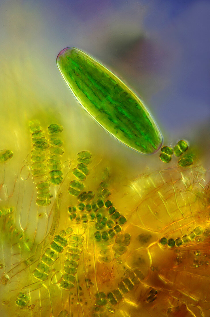 Desmid, algae and sphagnum moss, light micrograph