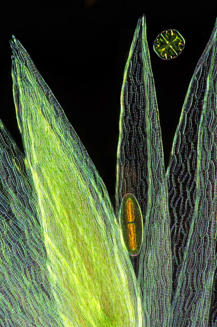 Desmids on sphagnum moss, light micrograph