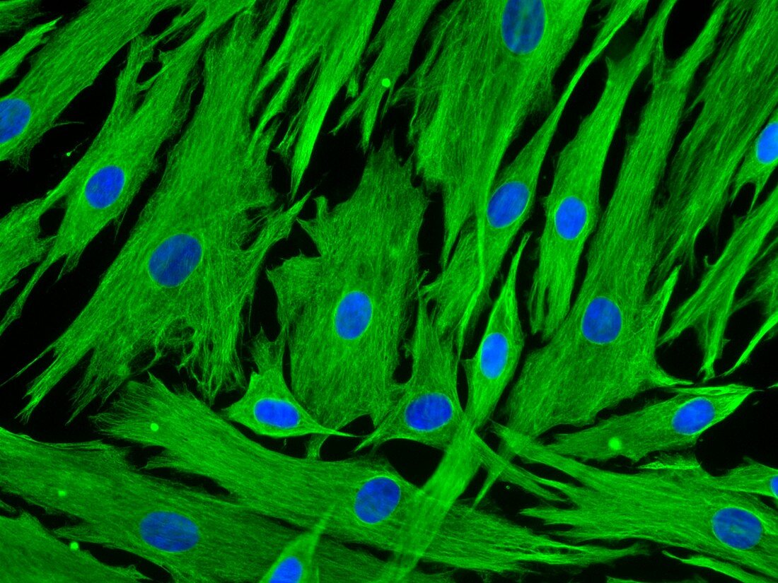 Hair follicle cells, fluorescence light micrograph