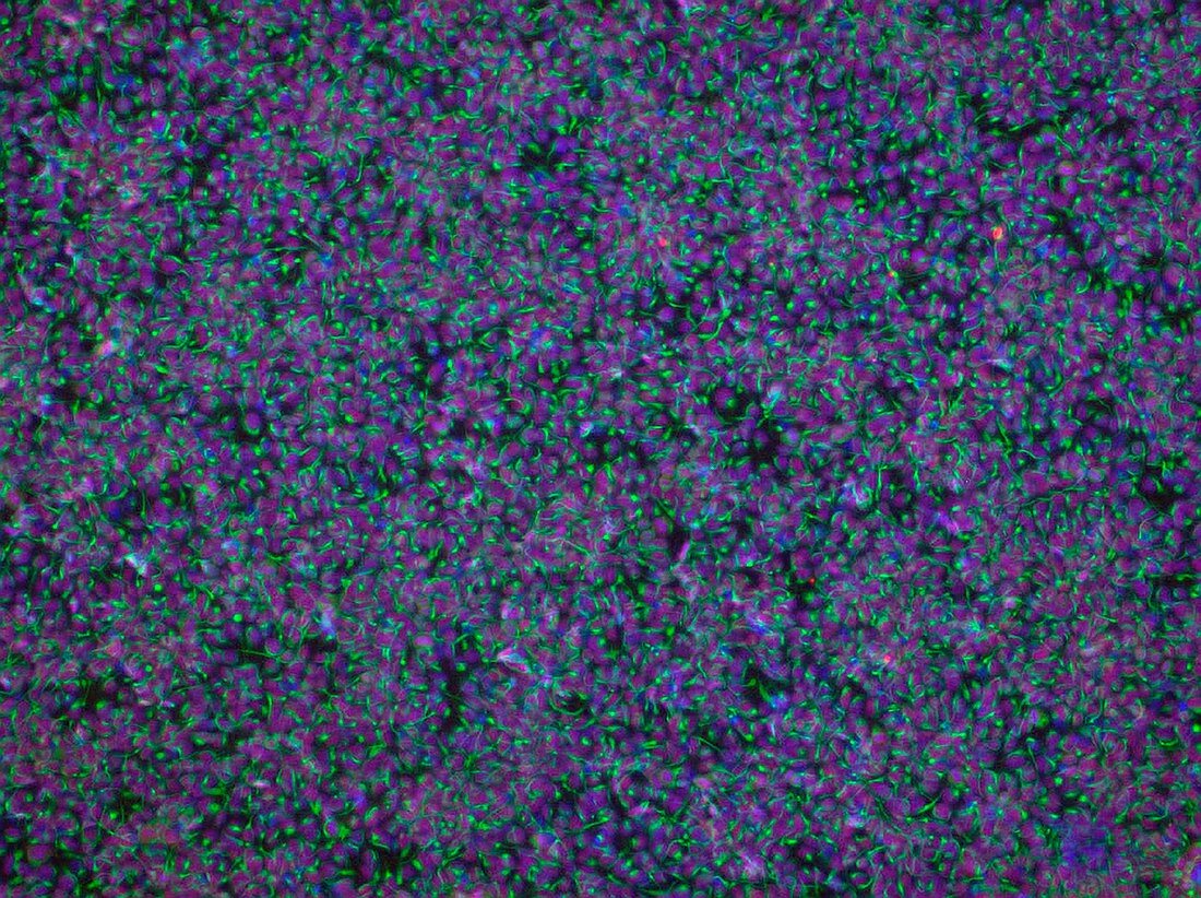 Neural stem cells, fluorescence light micrograph