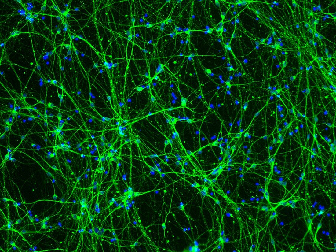 Neurons from stem cells, fluorescence light micrograph