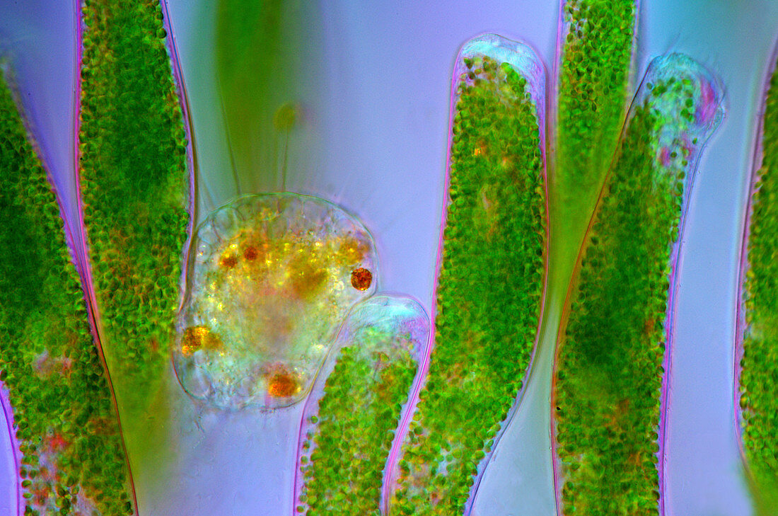 Ophrydium and heliozoan protozoa, light micrograph