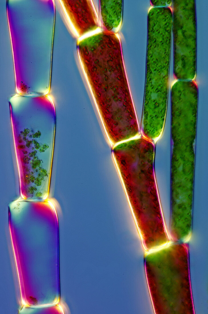Cladophora green algae, light micrograph