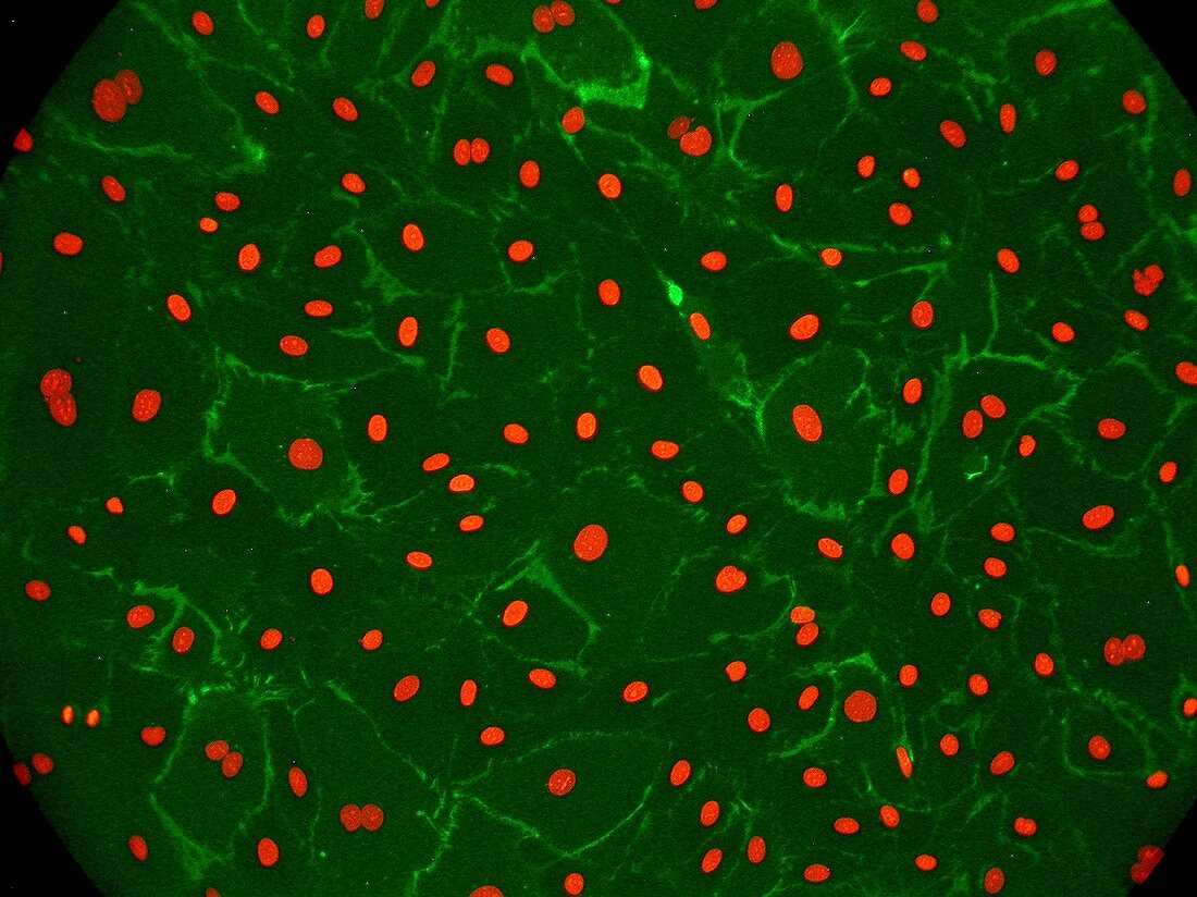 Dermal endothelial cells, fluorescence light micrograph