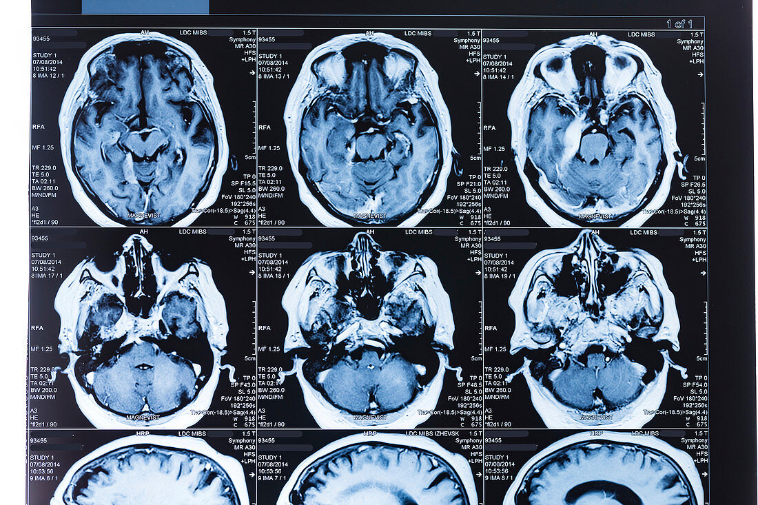 MRI scans of the human brain