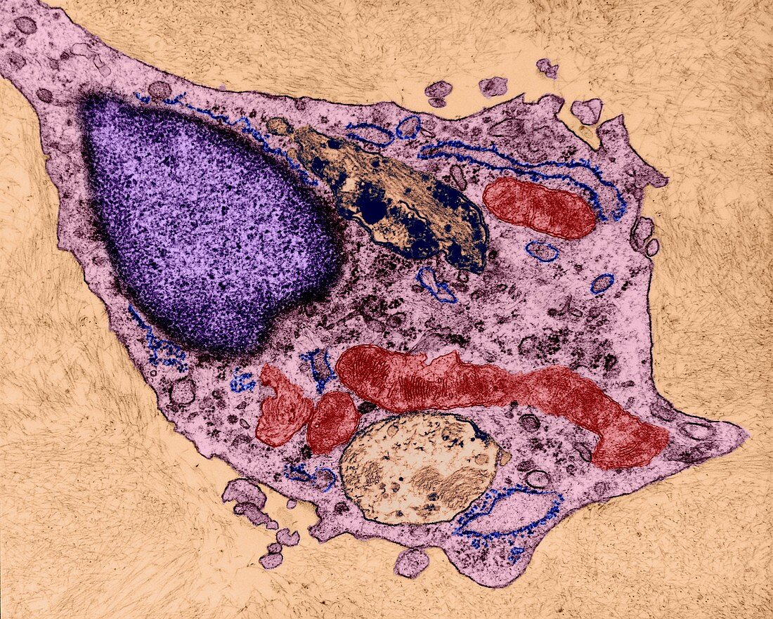 Neuroglia cell destroying betaamyloid, TEM