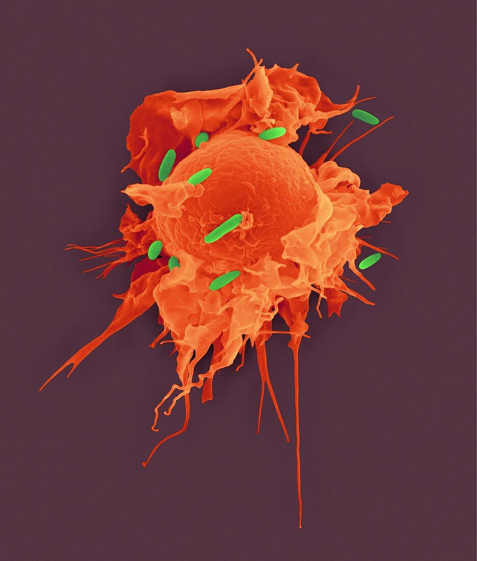 Alveolar tissue macrophage phagocytosis, SEM