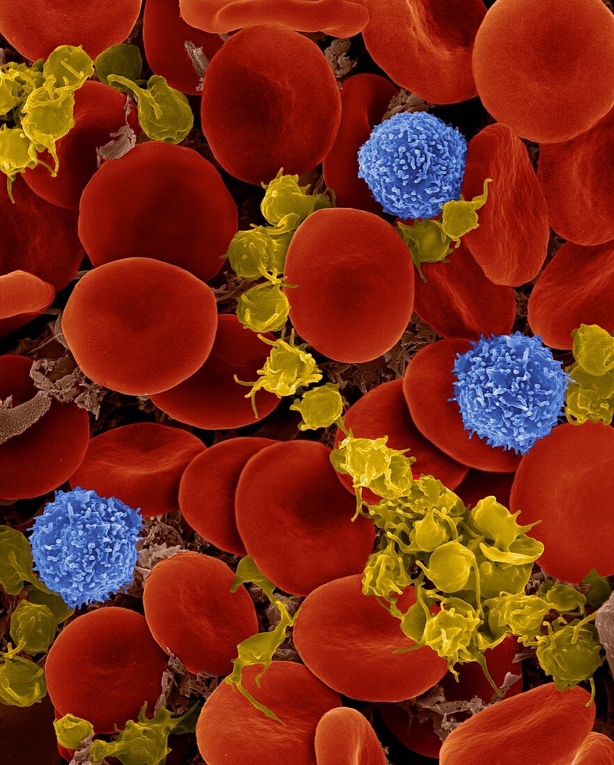 Red blood cells, T lymphocytes and activated platelets, SEM